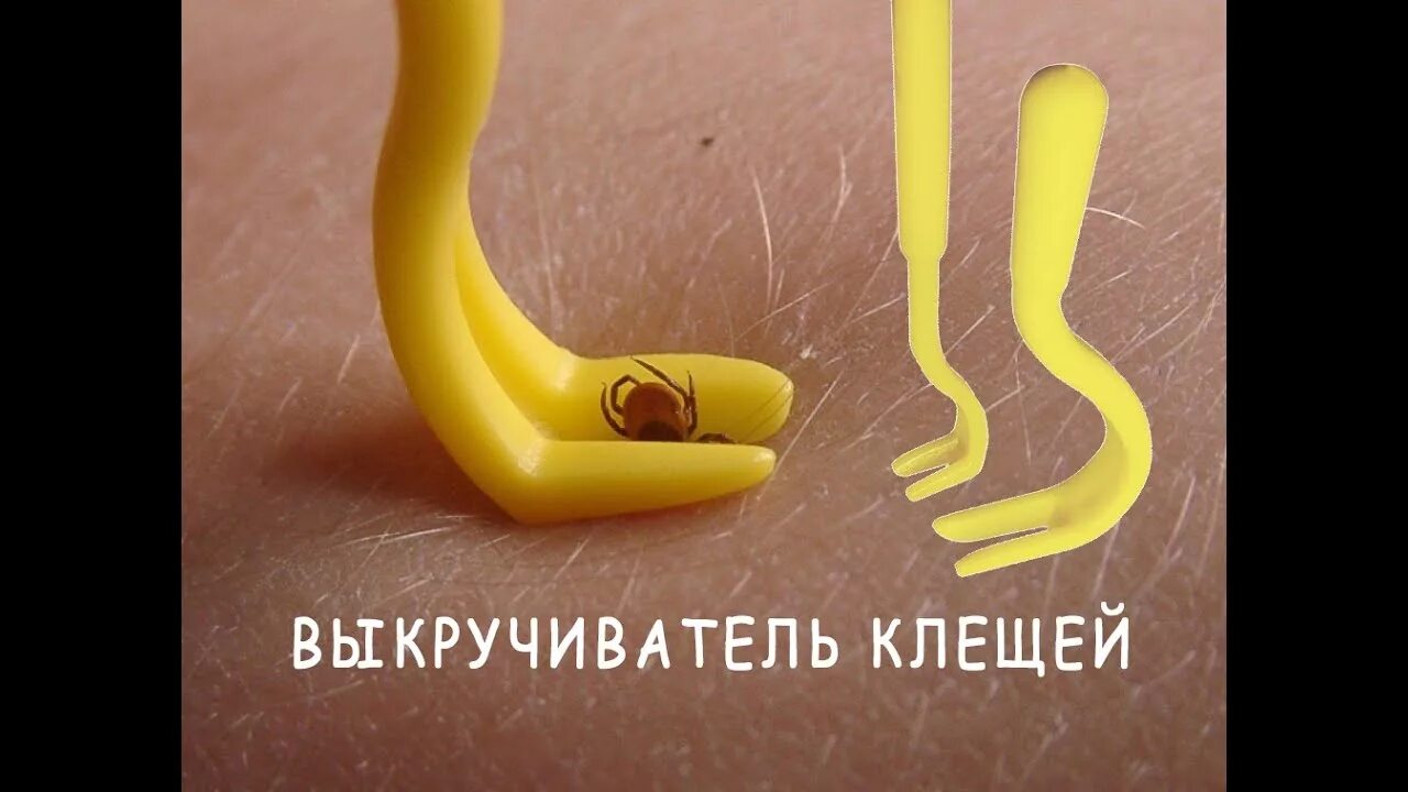 Выкручиватель клещей набор 2 штhelp. Выкручиватель клещей. Выкручиватель клещей. Выкручиватель клещей набор. Ложка для клещей.