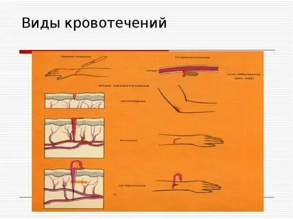 Кровотечения хирургия