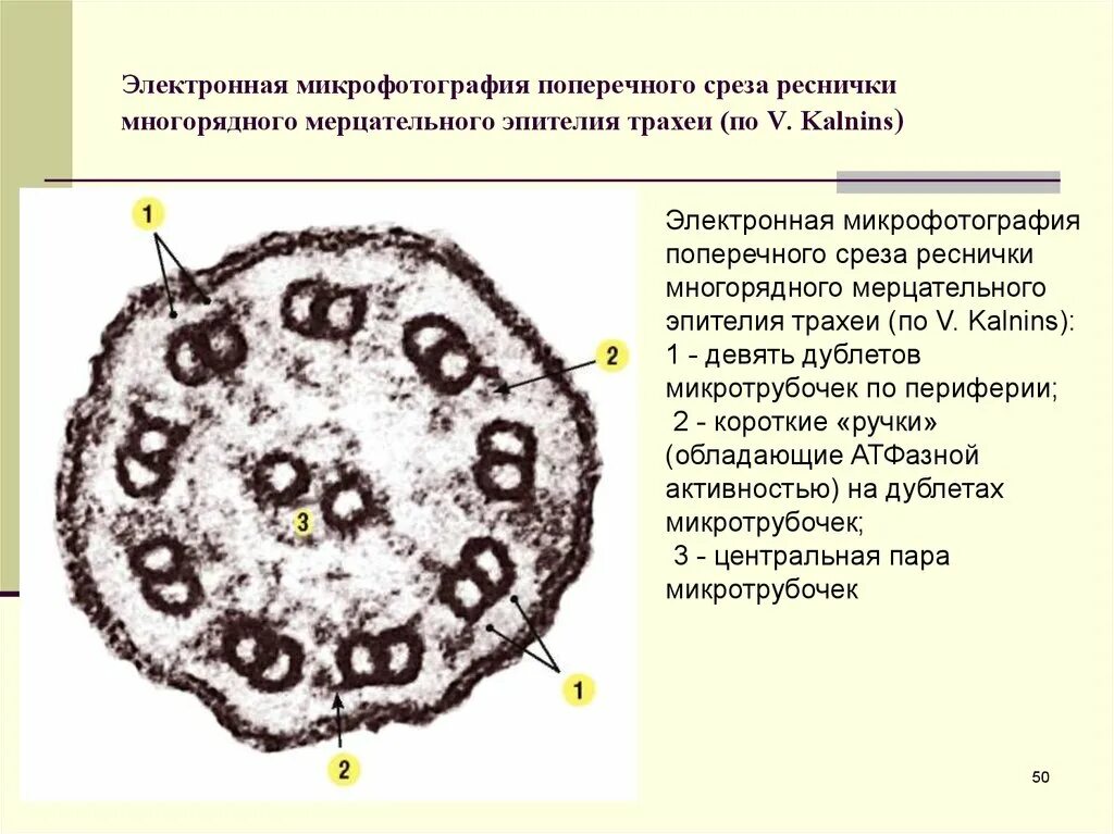 Какую функцию выполняет структура представленная на микрофотографии