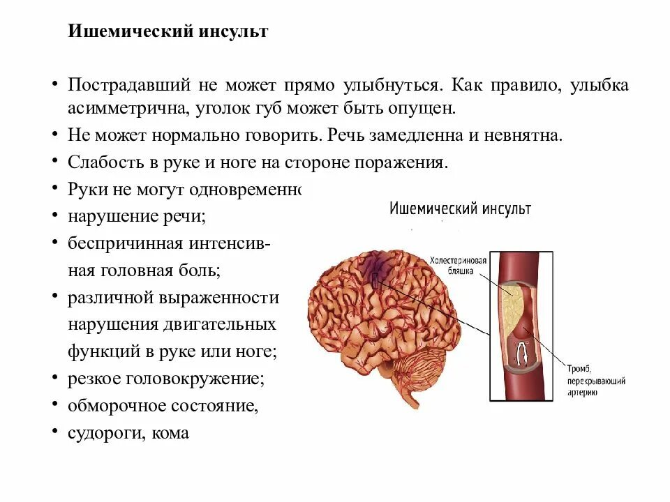 Ишемический инсульт нельзя. Классификация ишемического инсульта. Гормоны при ишемическом инсульте. Ишемический инсульт определение.