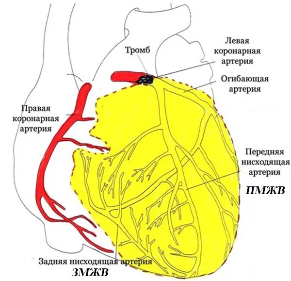 Левая огибающая коронарная артерия