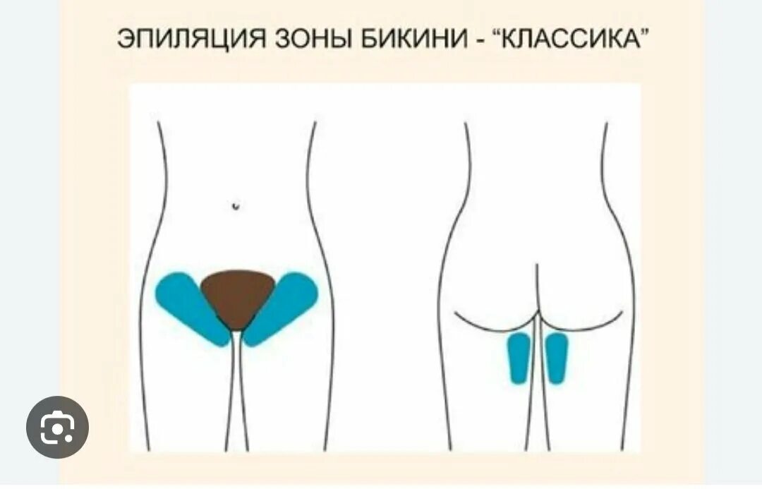 Депиляция бикини классика. Зона эпиляции классическое бикини. Классическое бикини схема. Депиляция классическое бикини. Эпиляция бикини глубокое.