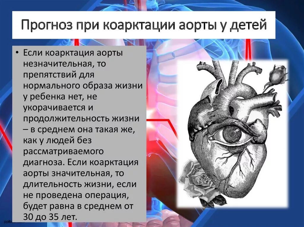 Операция прогноз