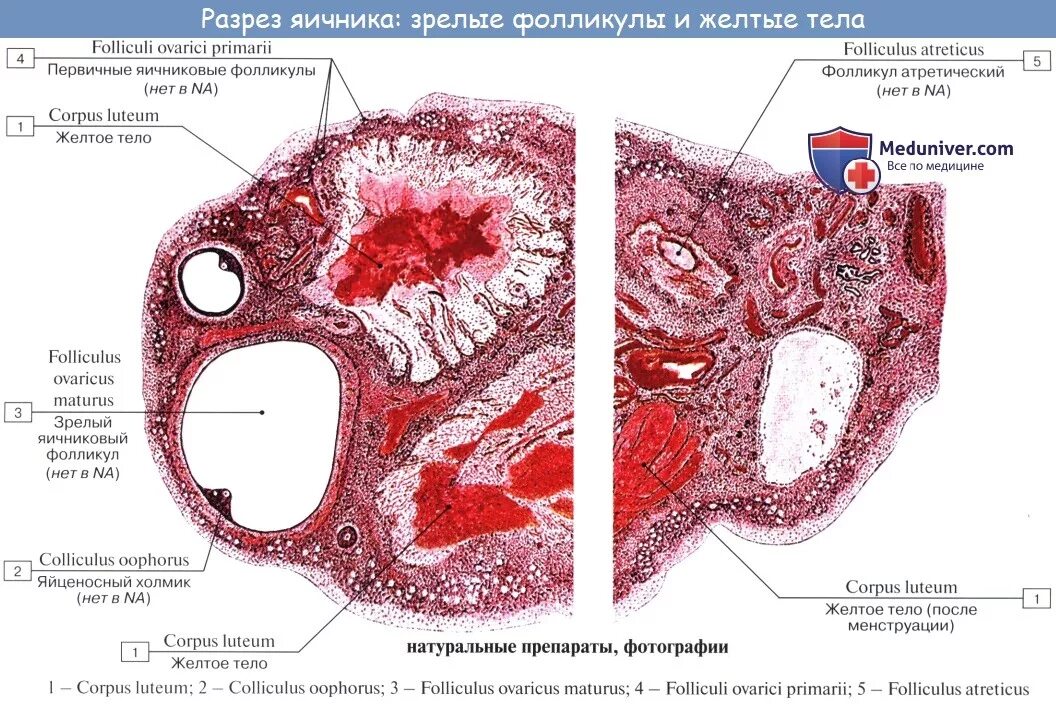 Строение яичника анатомия. Женская половая система гистология. Строение яичника гистология.