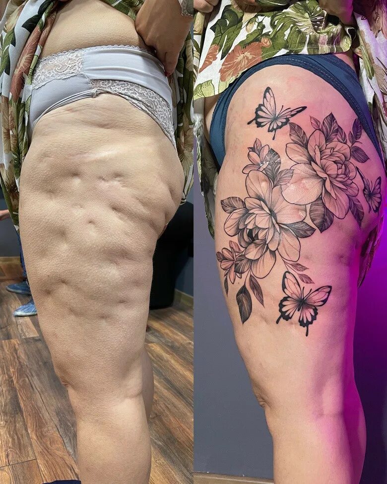 Закрыть шрам татуировкой на руке. Тату перекрывающие шрамы. Тату для перекрытия шрамов на руке девушке. Тату перекрывающие шрамы. Эскизы для перекрытия шрамов.