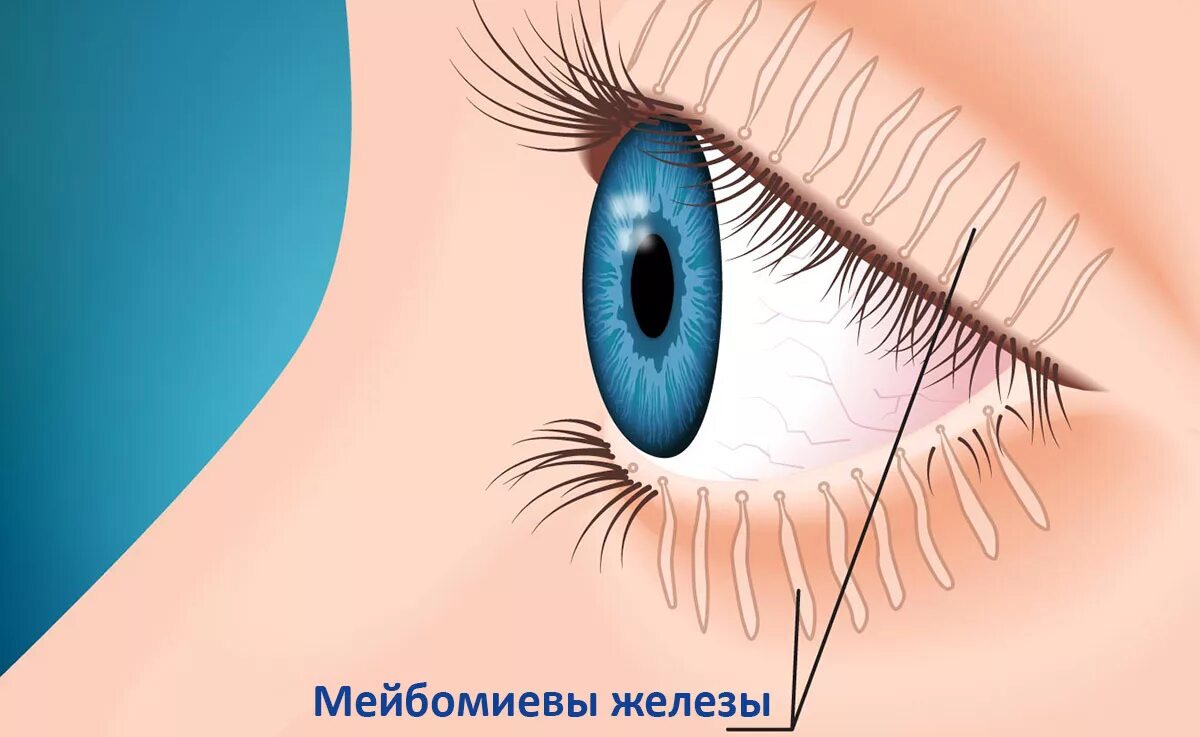 Где край века. Дисфункция мейбомиевых желез блефарит. Мейбомиевые железы глаза. Блефарит конъюнктивит ячмень.