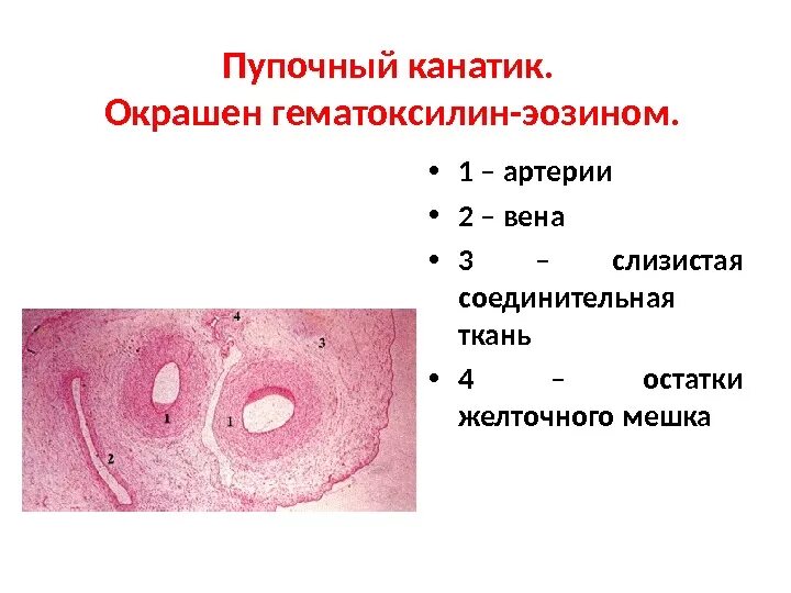 Строение пуповины гистология. Пупочный канатик строение. Пуповина гистология препарат. Пуповина свиньи слизистая ткань.