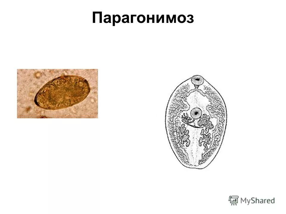 Печеночный сосальщик впр. Яйца ланцетовидного сосальщика. Парагонимус вестермани. Яйца легочного сосальщика. Жизненный цикл легочного сосальщика.