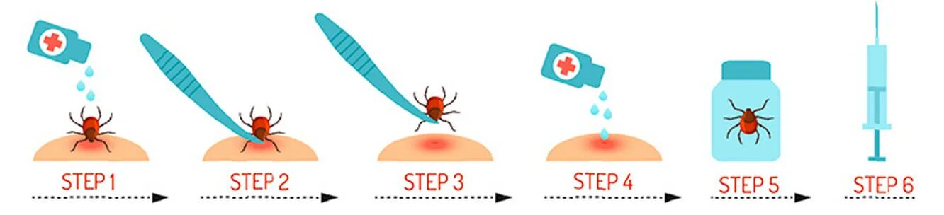 Как удалить клеща у человека самостоятельно. Алгоритм удаления клеща. Алгоритм извлечения клеща.
