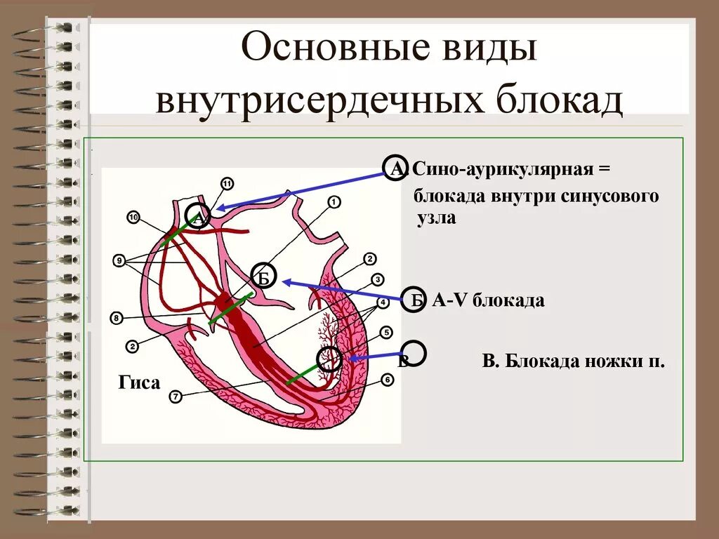Блокада узла. Блокада синусового узла. Блокада синусового узла сердца. Аурикулярная блокада. Внутрисердечная блокада.
