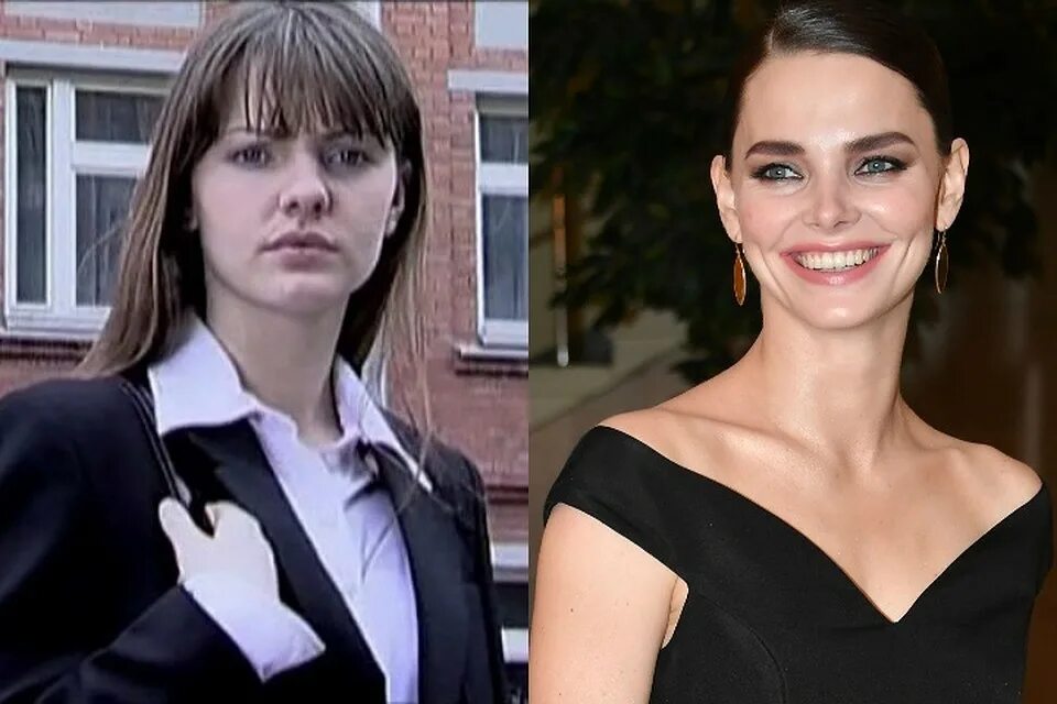 Боярская ринопластика до и после. Боярская ринопластика до и после. Боярская ринопластика до и после. Боярская ринопластика до и после. Боярская ринопластика до и после.