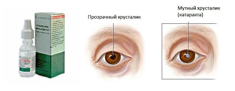 Катаракта капли глазные. Капли от старческой катаракты глазные. Капли для глаз при начальной катаракте.