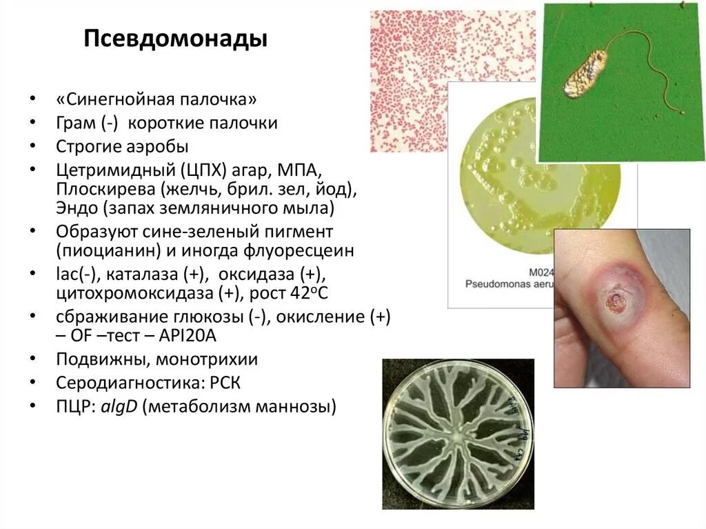 Инфекция латынь. Клинические проявления синегнойной палочки. Инфекции вызванные синегнойной палочкой. Псевдомонады микробиология морфология. Синегнойная палочка заболевания микробиология.