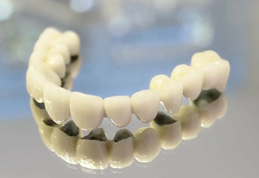 Металлокерамический мостовидный протез. Мостовидные протезы ортопедическая стоматология. Зубные мосты несъемные из металлокерамики. Металлокерамика с гирляндой.
