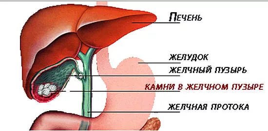 Как болит печень и желчный. ЖКБ камни желчного пузыря. Микролиты в желчном пузыре. Печень и желчный пузырь. Желчный пузырь изображение.