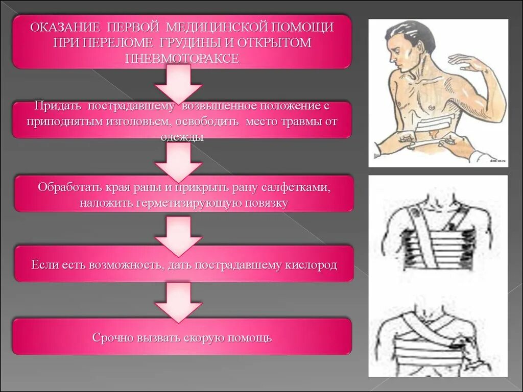 Оказание первой помощи при травме грудной клетки. Алгоритм оказания первой помощи при ранении грудной клетки. Алгоритм оказания 1 помощи при ранениях грудной клетки. Алгоритм оказания первой помощи при открытом.