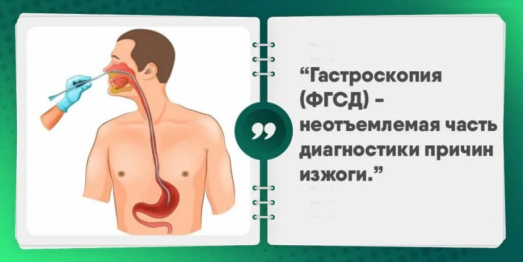 Почему может быть изжога. Изжога причины. Заболевания сопровождающиеся изжогой.