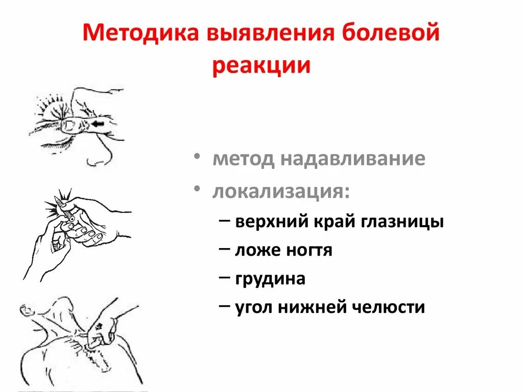 Болезненно реагирует. Способ проверки болевой реакции. Болевое раздражение. Реакция на болевой раздражитель. К способам проверки болевой реакции относится:.