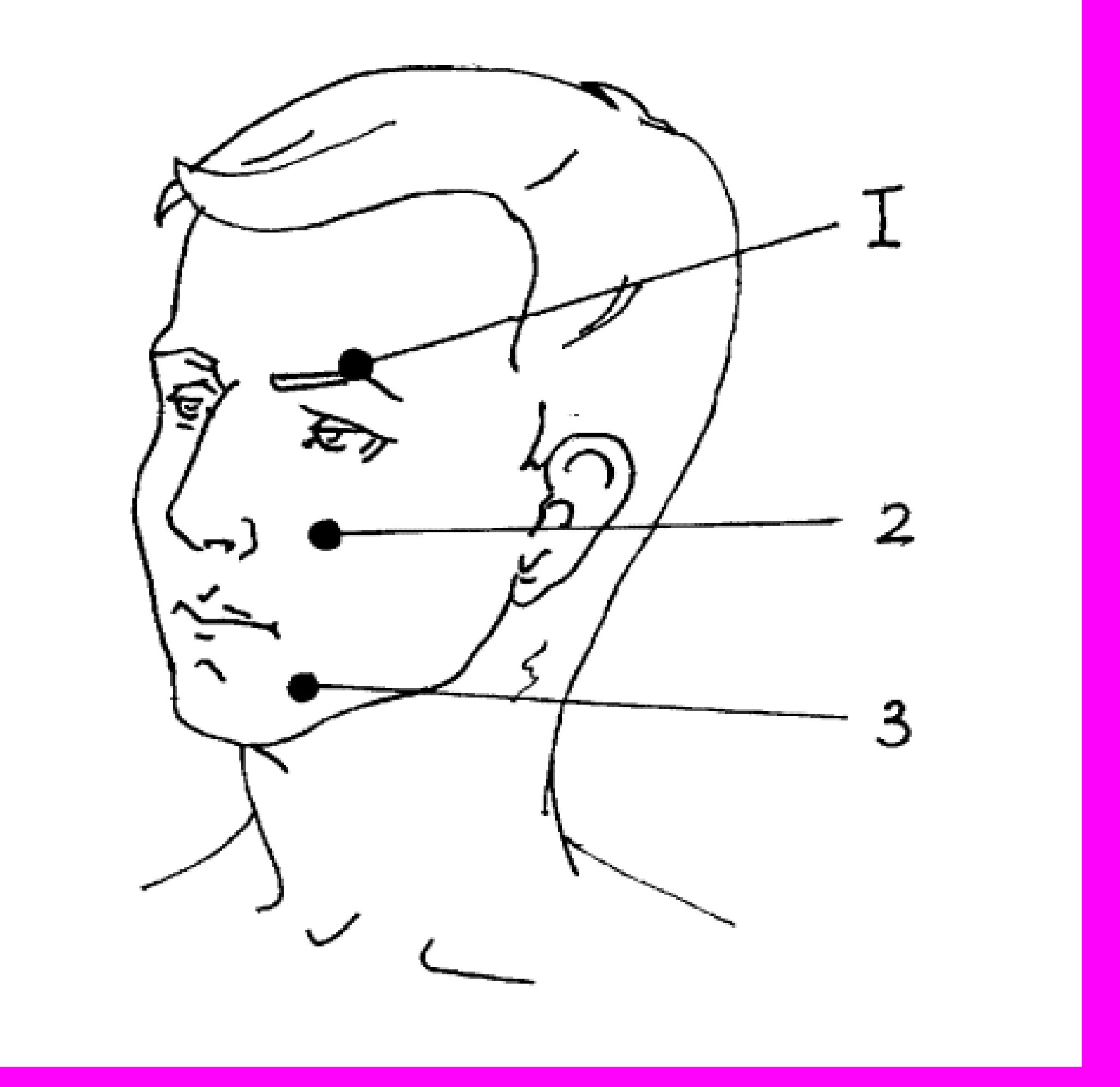 А 4 чтоб точка. Точки для усыпления человека. Точки на шее для усыпления человека. Сонные точки у человека. Точки выхода лицевого нерва на лице.