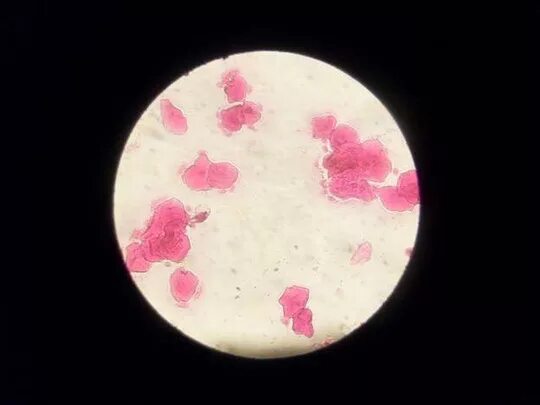 овуляция у собак. лейкоциты в женском мазке. лейкоциты в мазке под микроскопом. овуляция у собак. овуляция по слюне под микроскопом.