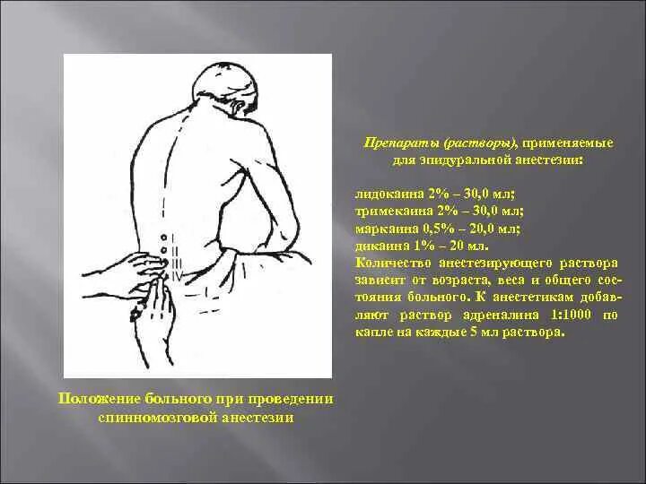 Как действует блокада. Для перидуральной анестезии применяют. Новокаиновые блокады применяют для. Новокаиновая блокада в спину.