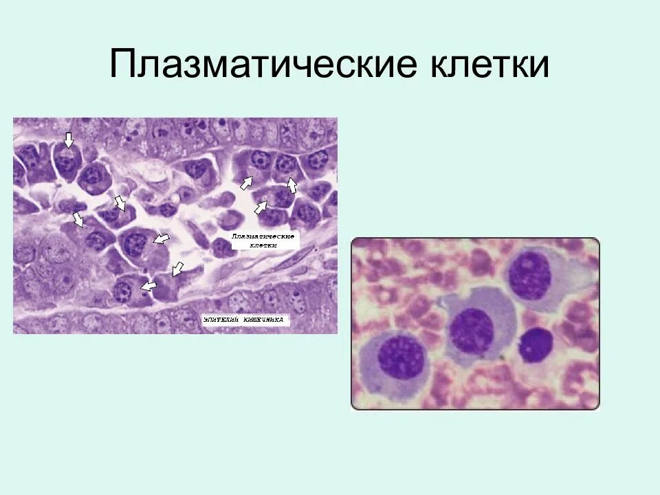 1 плазматическая клетка. Плазматические клетки под микроскопом. Плазматические клетки соединительной ткани. Плазматические клетки гистология. Плазмоциты в соединительной ткани.