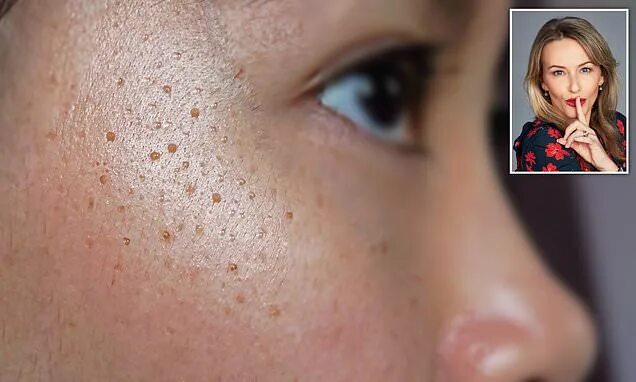 Dermatology Blog for Greater Houston, TX DermSurgery Associates