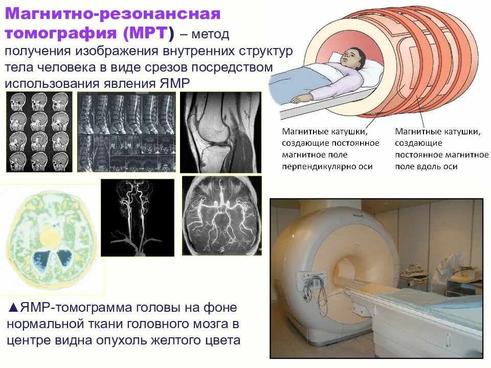 Магнитно резонансная томография является методом. Ядерный магнитный резонанс в медицине. ядерно-магнитно-резонансная томография. ямр томография. магнито ядерная томография.