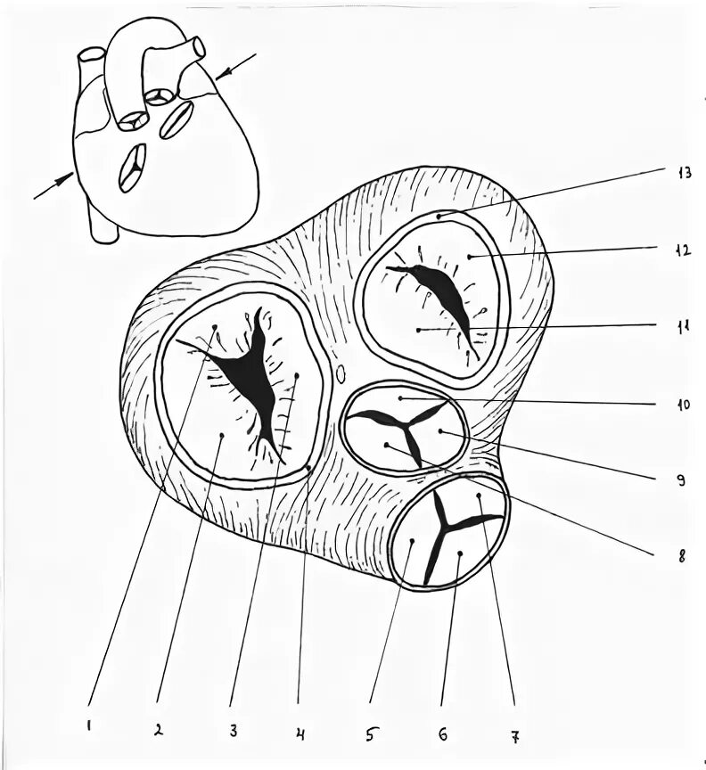 Строение сердца с клапанами схема. Фиброзный скелет сердца схема. Легочный клапан сердца анатомия.