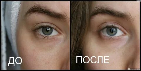 Лучшее от темных кругов под глазами