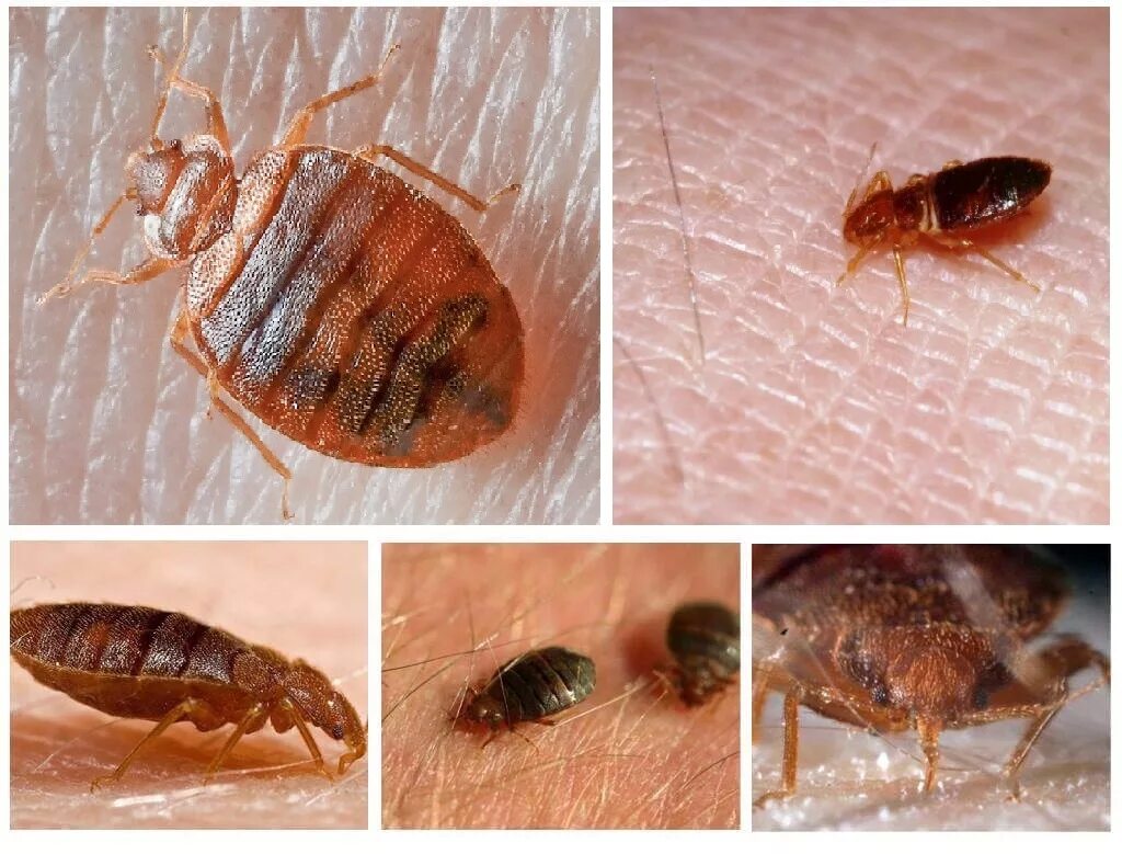 Вши в диване. Вши в диване. Гнездо постельных клопов. Бельевые клопы санэпидемстанция. Гнездо бельевых клопов.