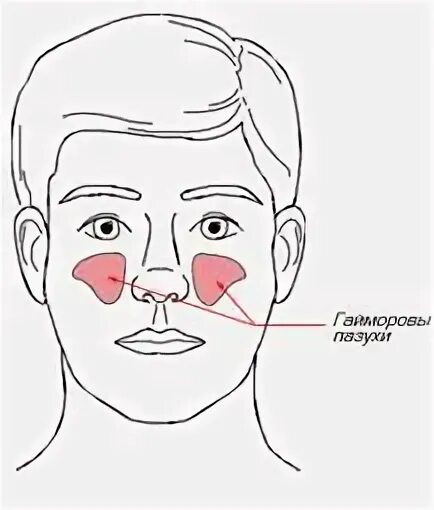 Синусит можно греть нос. Схема гайморовых пазух. Прогревание носовых пазух.