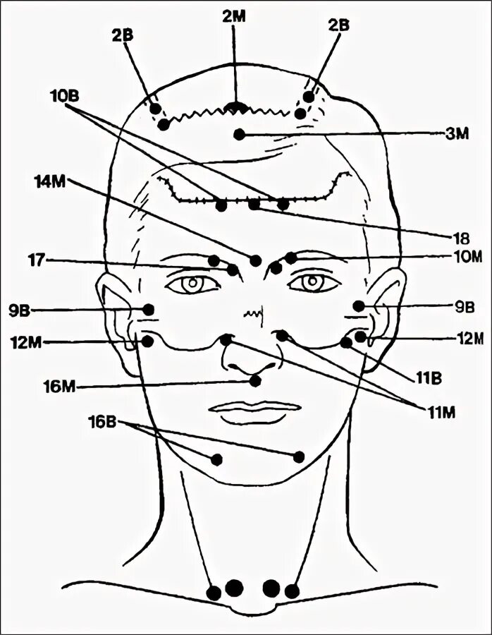 Лба 2 8. Акупунктура тела человека схема болевые точки. Акупунктурные точки на голове человека. Акупрессура точечный массаж акупунктура. Акупрессура – точечная рефлексотерапия.
