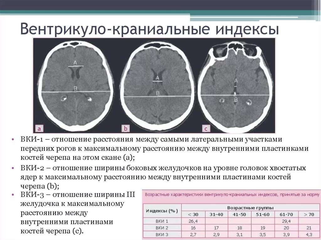 Расширение боковых рогов