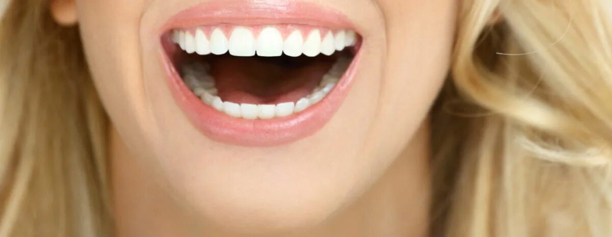 Сильно сжатые зубы. Голливудская улыбка Минимализм.