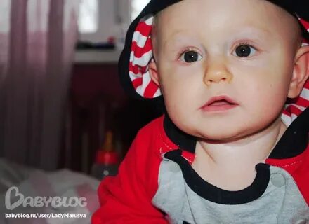 У ребенка желтый нос