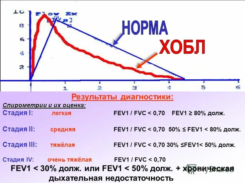 Картинки СПИРОГРАФИЯ НОРМА