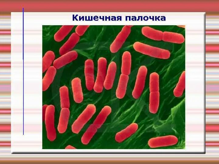 Свойства кишечной палочки. Микробиолог кишечная палочка. Кишечная палочка микро. Кишечная палочка e.coli. Микроб кишечная палочка.