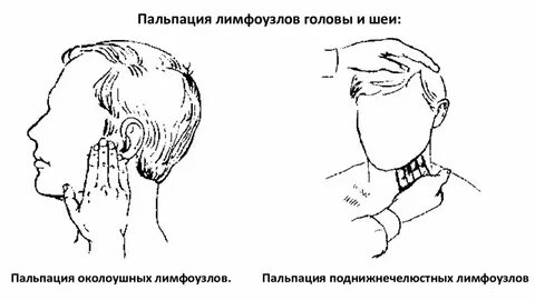 Пальпация регионарных лимфатических узлов