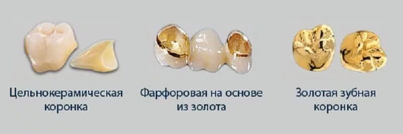 Золотые зубные коронки. Коронка металлическая с золотым напылением. Металлическая коронка на зуб.
