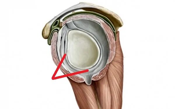 Суставная губа гленоида плечевого сустава. Фиброзно-хрящевая губа гленоида плечевого сустава. Разрыв гленоида плечевого сустава. Суставная фиброзно-хрящевая губа гленоида плечевого сустава. Разрыв губы гленоида