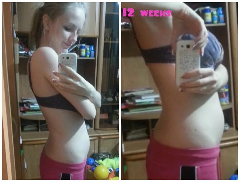 11 недель беременности фото двойня. Животик на 11 неделе. 10 недель беременности живот форум. Живот беременной на 9 неделе. Живот на 14 акушерской неделе.