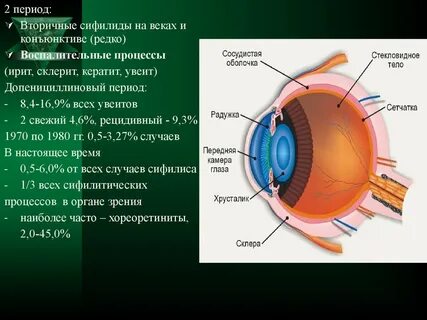Переднее время