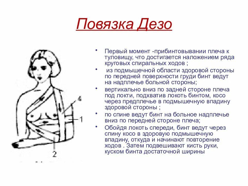 Дезо алгоритм. Порядок наложения повязки Дезо. Методика наложения повязки Дезо. Повязка Дезо техника наложения. Наложение повязки Дезо алгоритм.