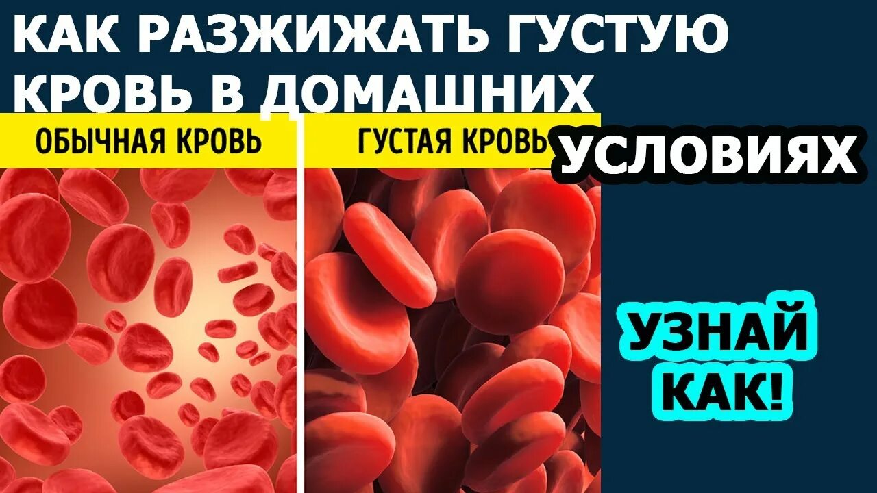 Густая кровь народными. Что разжижает кровь. Густая кровь как разжижать. Донник лекарственный разжижает кровь.