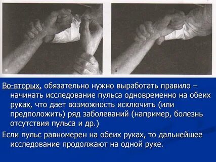 Качество артериального пульса