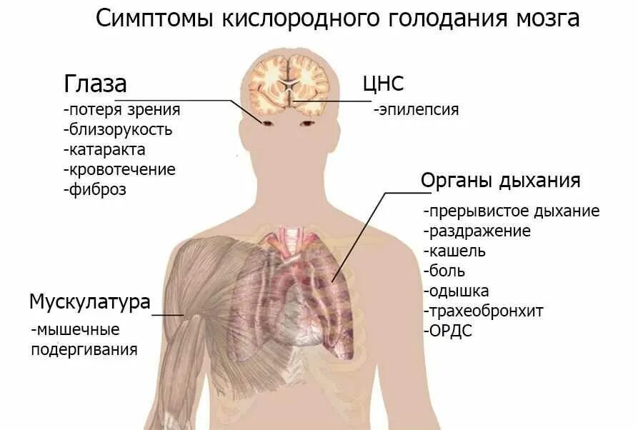 Начала задыхаться причины. Кислородное голодание мозга симптомы у взрослых. Кислородное голодание симптомы у взрослых. Признаки гипоксии головного мозга. Безкислороднте голодание.