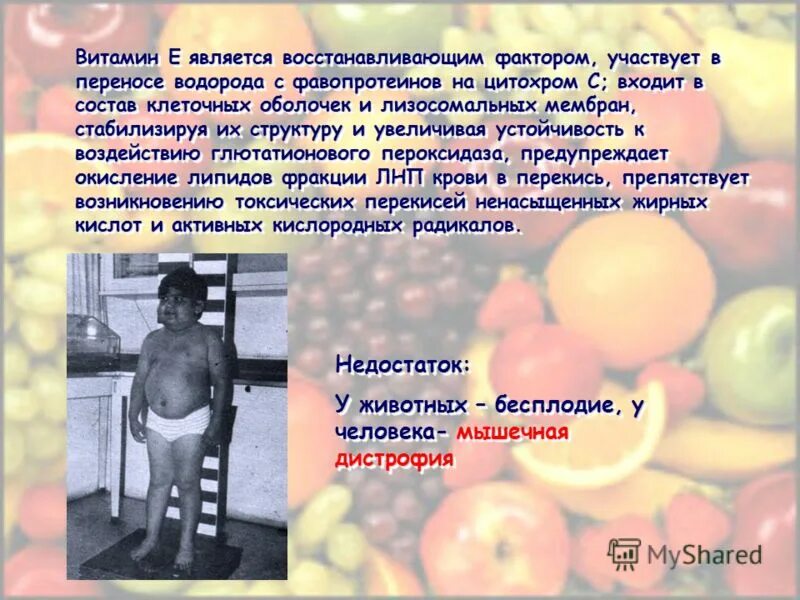 недостаток мышечной