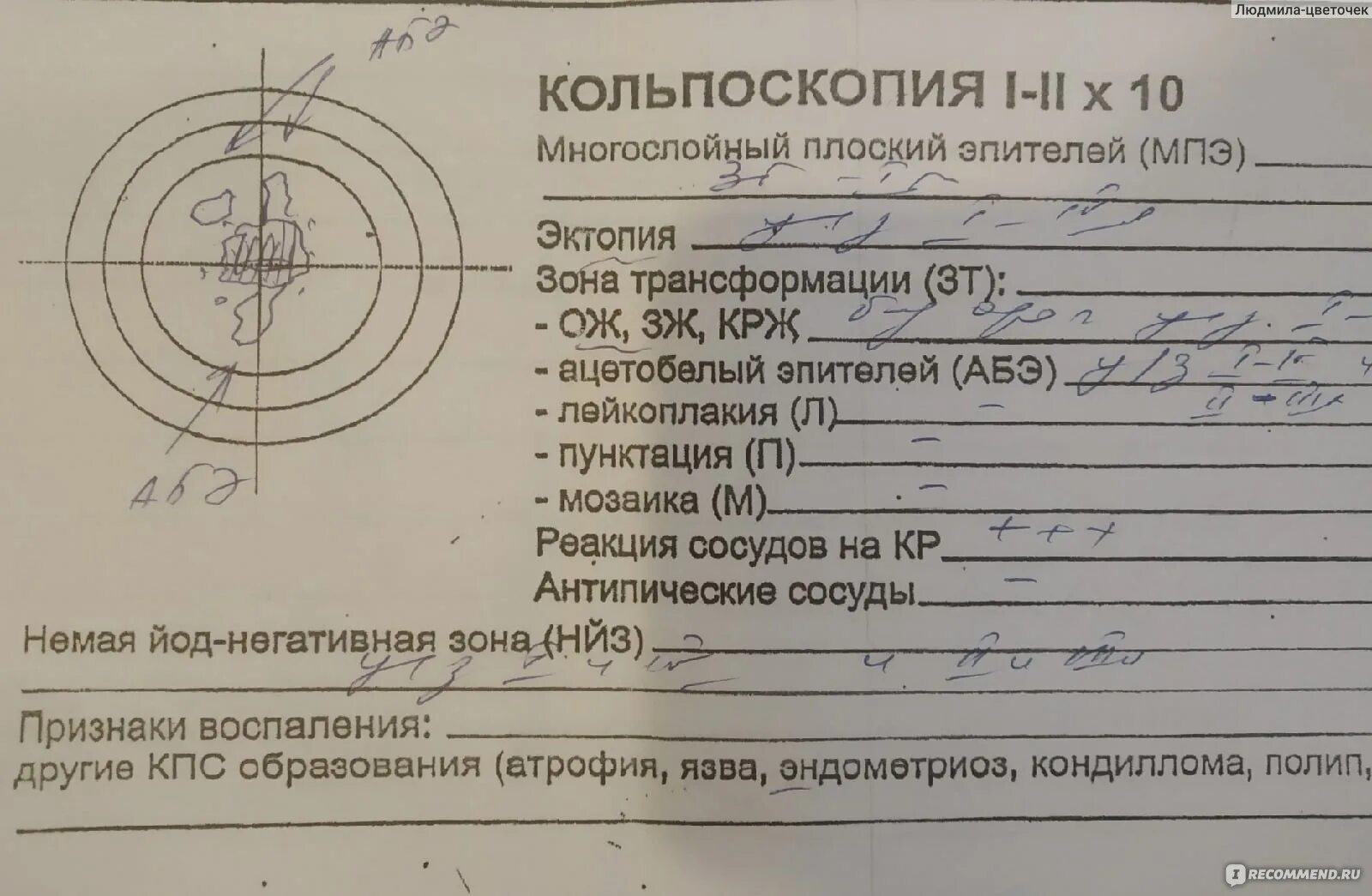 Крови после биопсии шейки