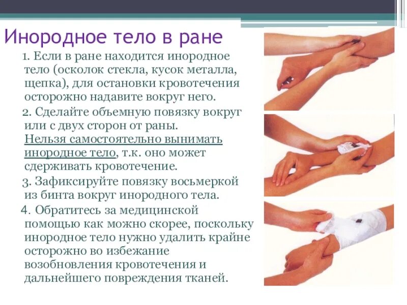 При ранении голени с сильным пульсирующим. Первая помощь при ранениях. оказание первой помощи при ранении стеклом. инородное тело в ране первая помощь.